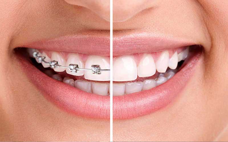 دندانپزشکی طالقانی کرج